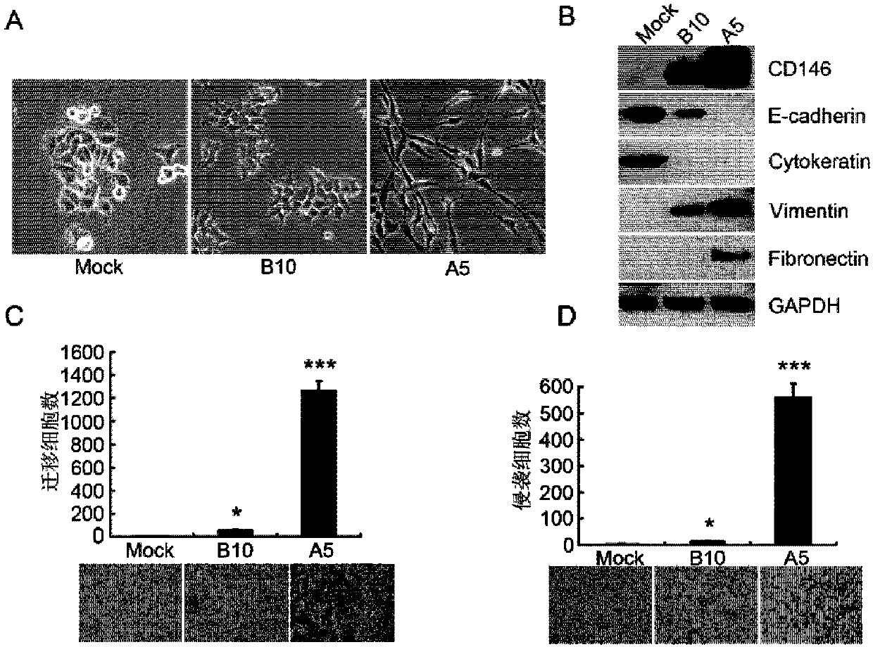 Application of CD146 and its antibody in diagnosis and treatment of triple negative breast cancer