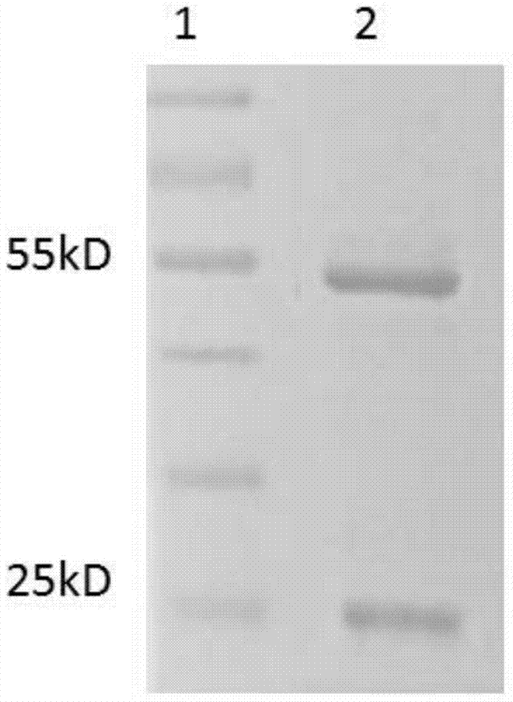 TgVP1 extracellular region antigen polypeptide, anti-TgVP1 polyclonal antibody and application of polyclonal antibody