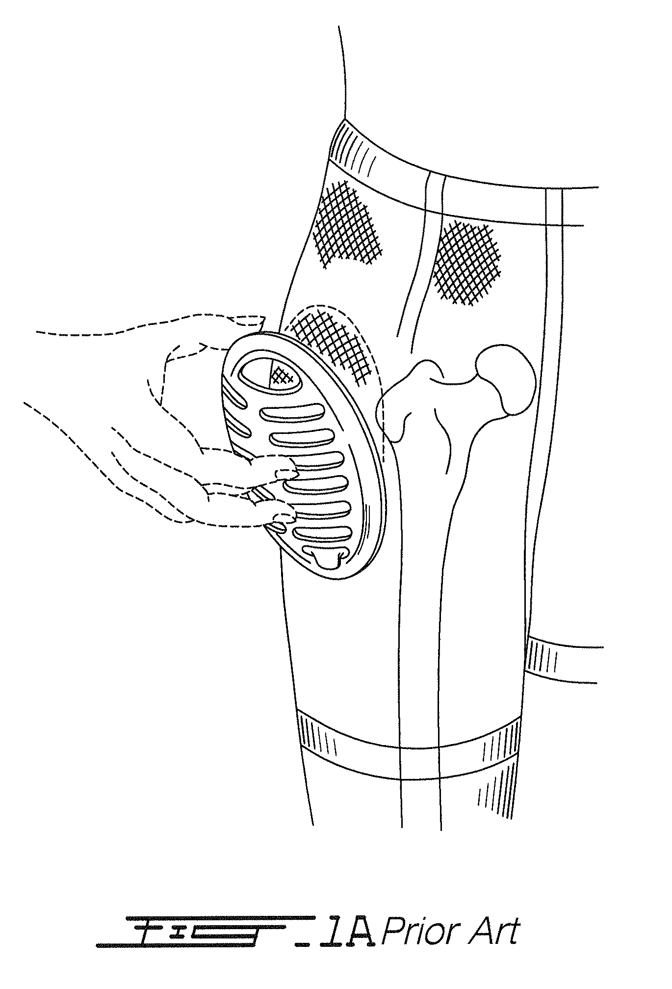 Compliant impact protection pad