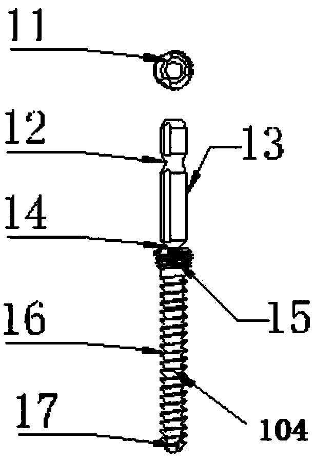 Inner combined fixing system for acetabular posterior wall