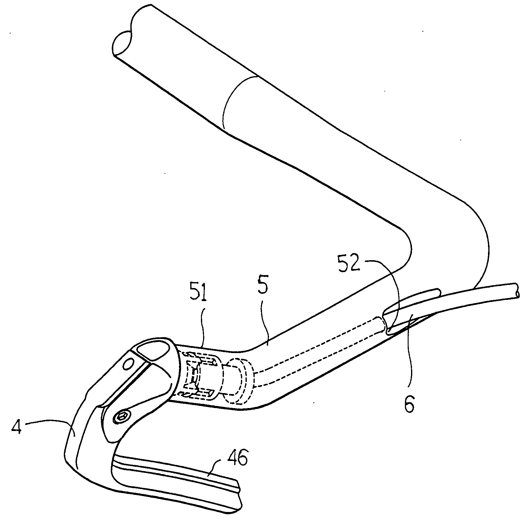 Embedding typed handbrake operating device