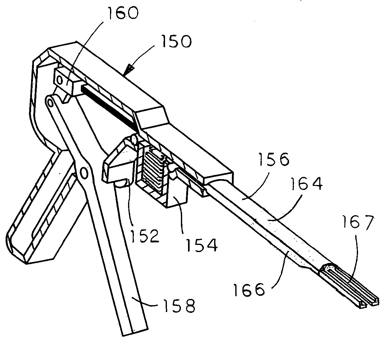 Tissue distraction device