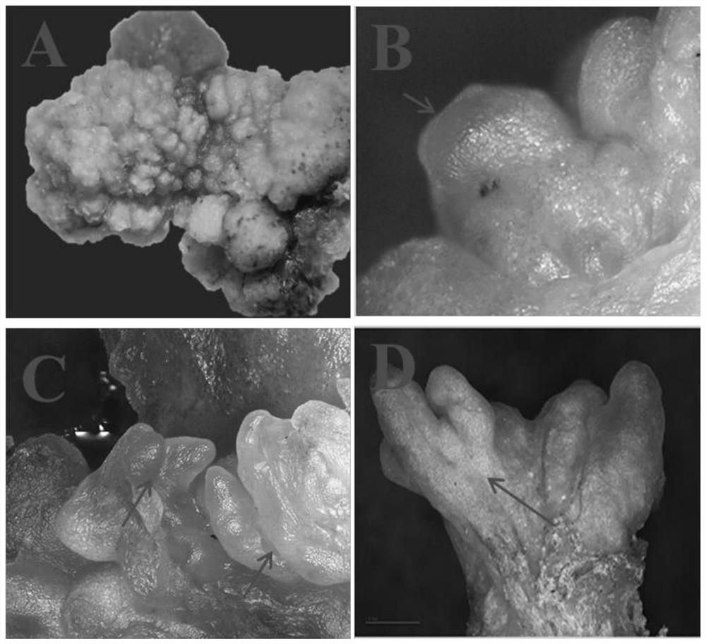 Method and culture medium for culturing peony cotyledons to directly form somatic embryos