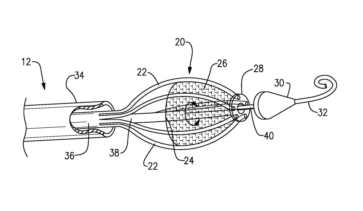 Left ventricle heart-assist device