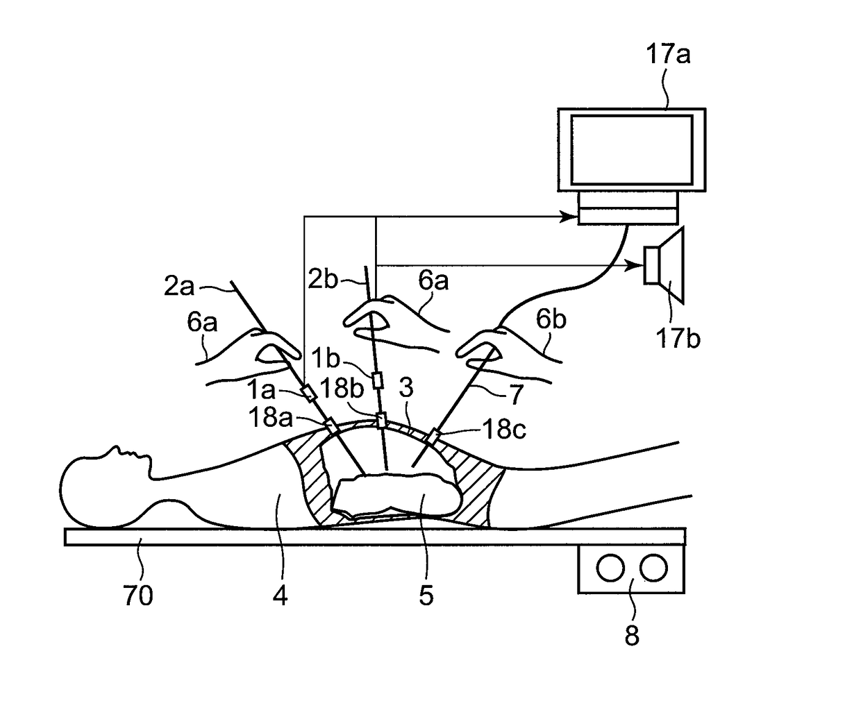 Force measurement apparatus, force measurement method, force measurement program, force measurement integrated electronic circuit, and master-slave device