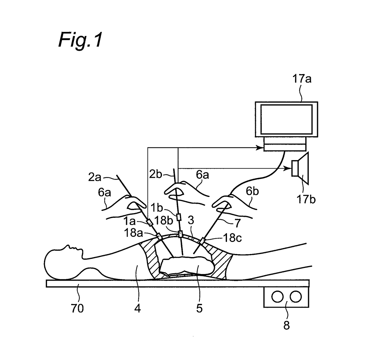 Force measurement apparatus, force measurement method, force measurement program, force measurement integrated electronic circuit, and master-slave device