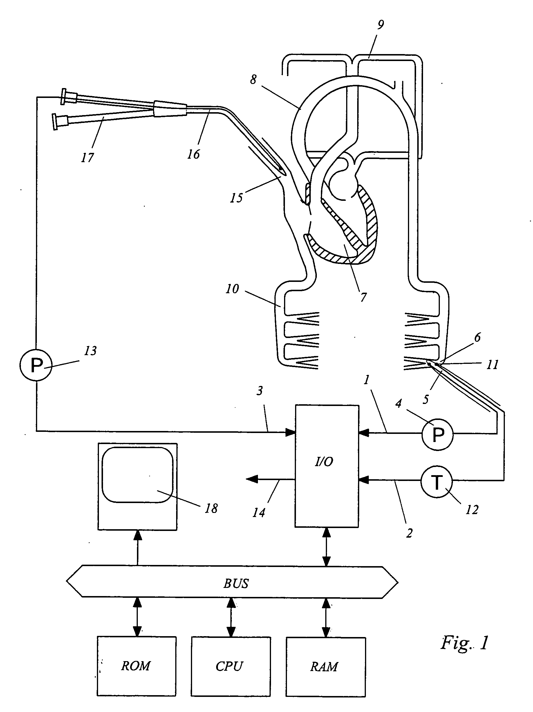 Device for determining a hemodynamic parameter