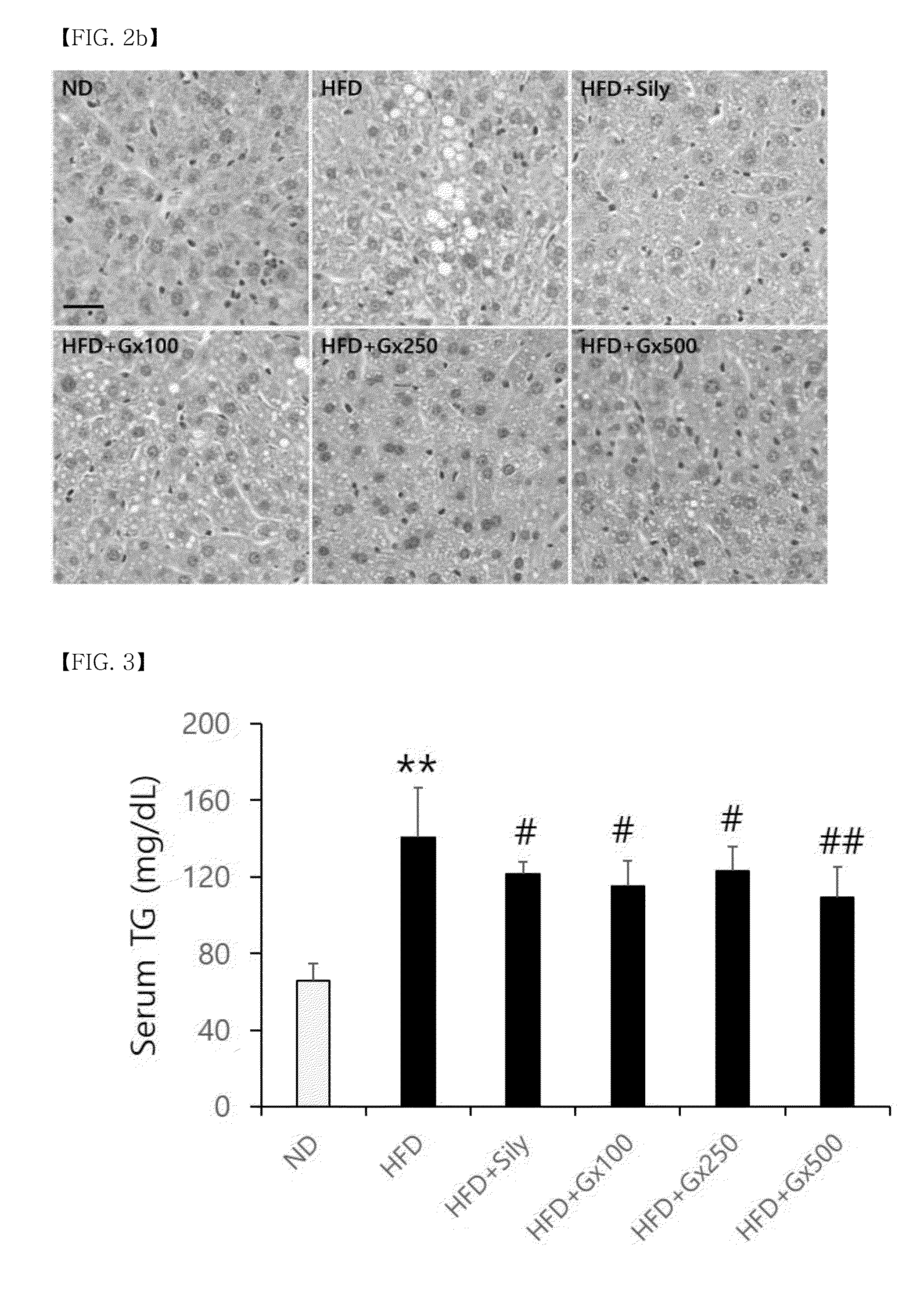 Pharmaceutical Composition and Health Functional Food Containing Red Ginseng Concentrate Having Enhanced Compound K for Preventing and Treating Non-alcoholic Fatty Liver Disease