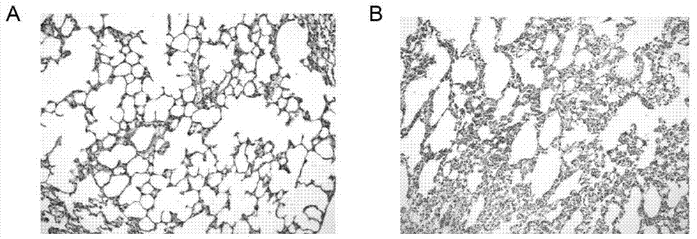 Primer for diagnosing lung lesions caused by chrysotile and man-made mineral fiber by using RT-PCR method