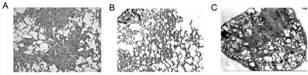 Primer for diagnosing lung lesions caused by chrysotile and man-made mineral fiber by using RT-PCR method