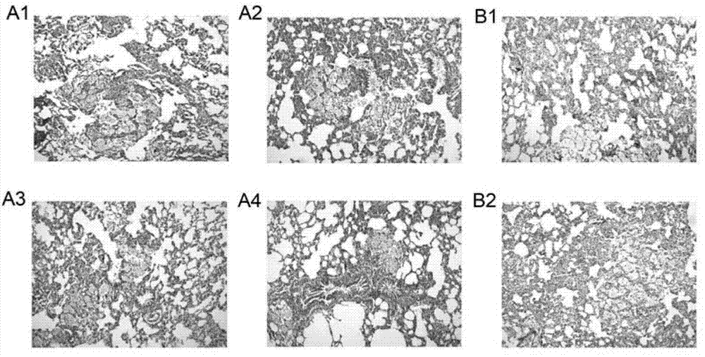 Primer for diagnosing lung lesions caused by chrysotile and man-made mineral fiber by using RT-PCR method