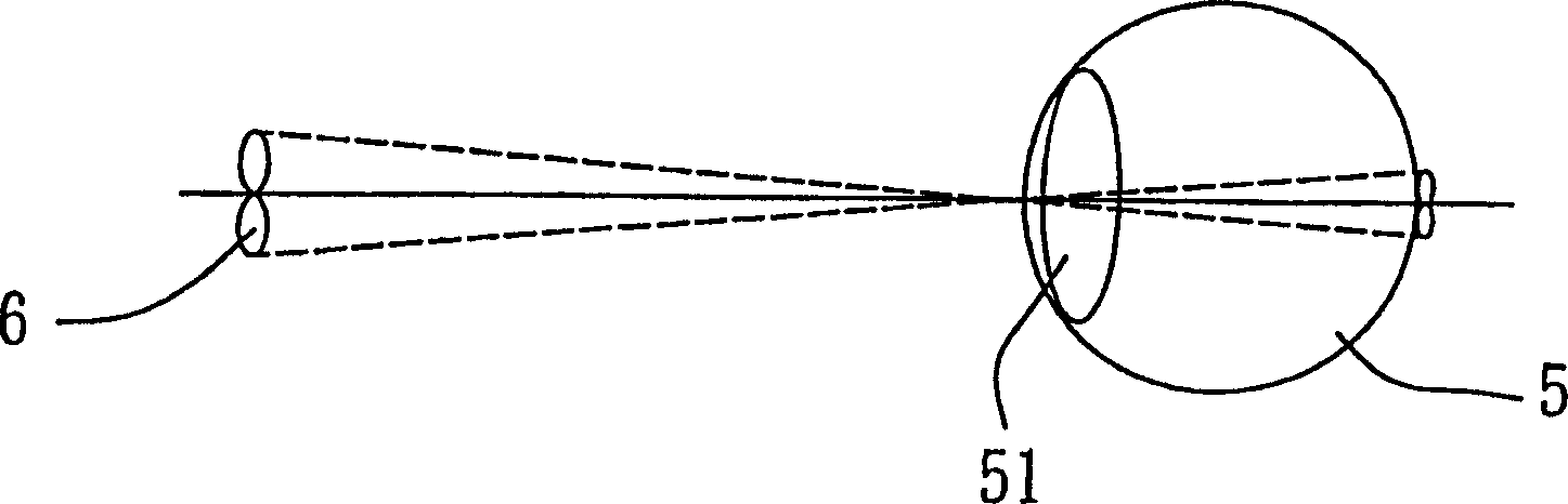 Double block refraction image display device with visual focal length compressing set