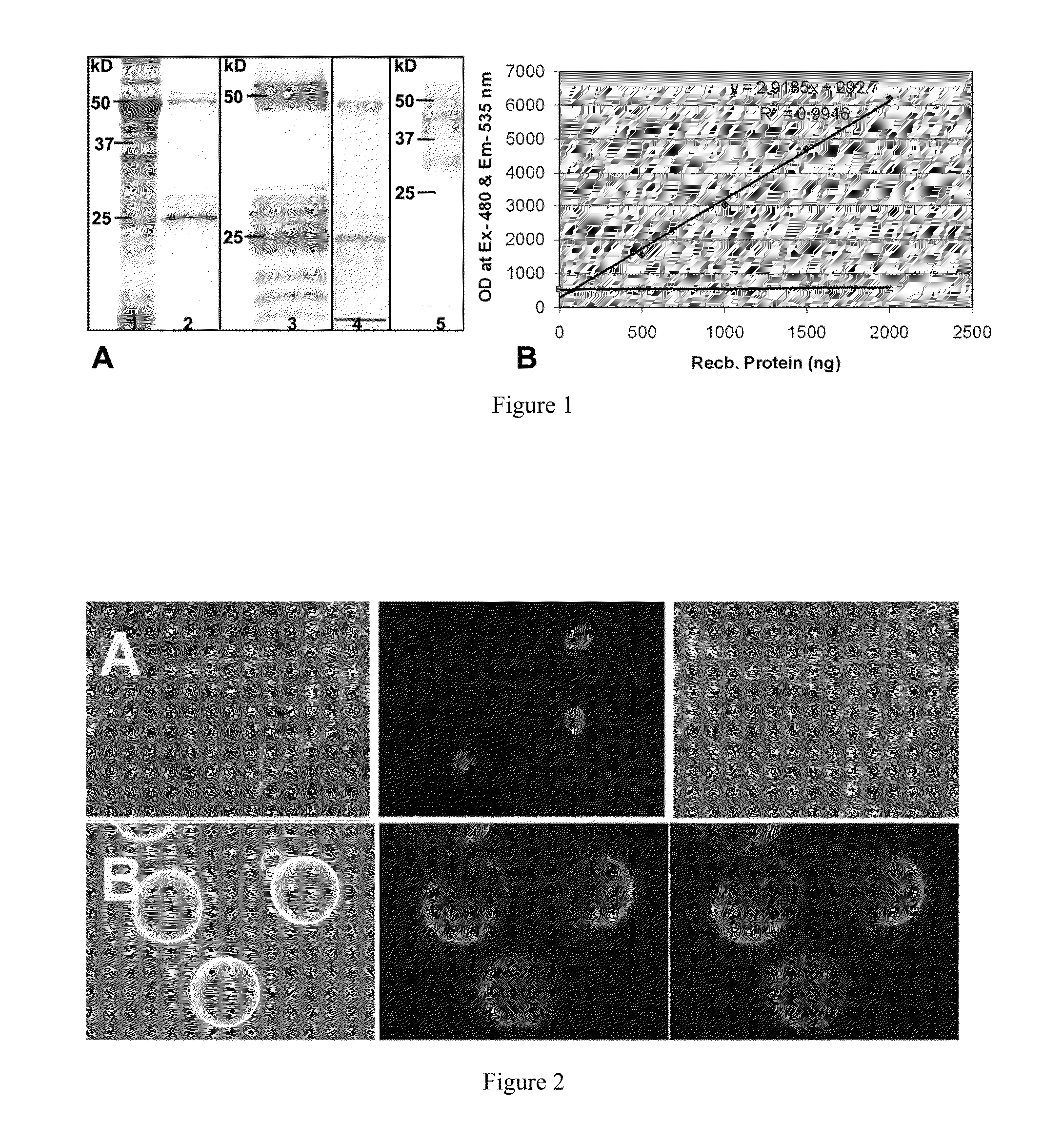 Compositions and methods for regulating sas1r