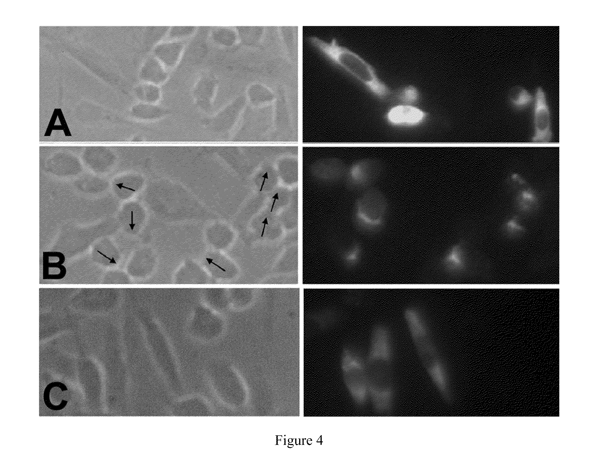 Compositions and methods for regulating sas1r