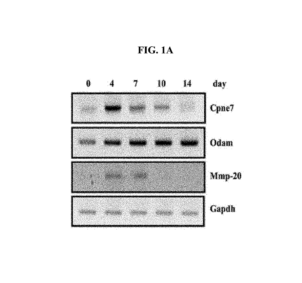 Use of CPNE7 for differentiating non-dental mesenchymal stem cells into odontoblasts, regenerating dental pulp and treating dentin hypersensitivity