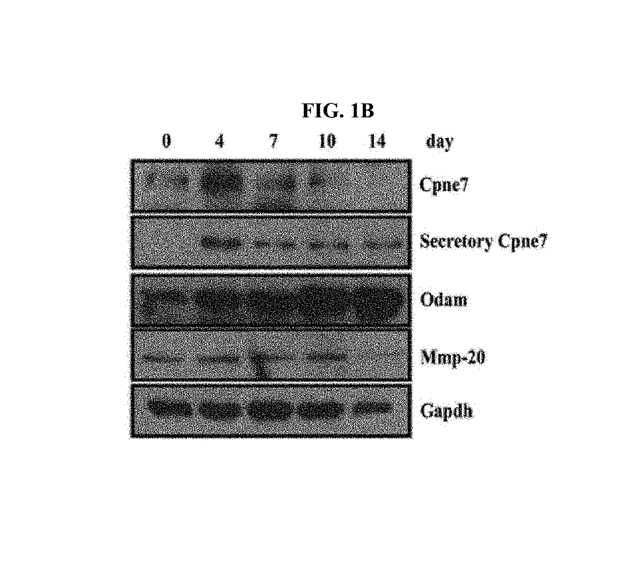 Use of CPNE7 for differentiating non-dental mesenchymal stem cells into odontoblasts, regenerating dental pulp and treating dentin hypersensitivity