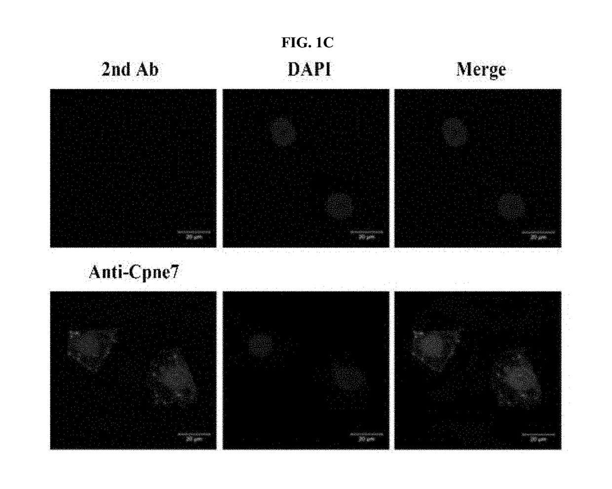 Use of CPNE7 for differentiating non-dental mesenchymal stem cells into odontoblasts, regenerating dental pulp and treating dentin hypersensitivity