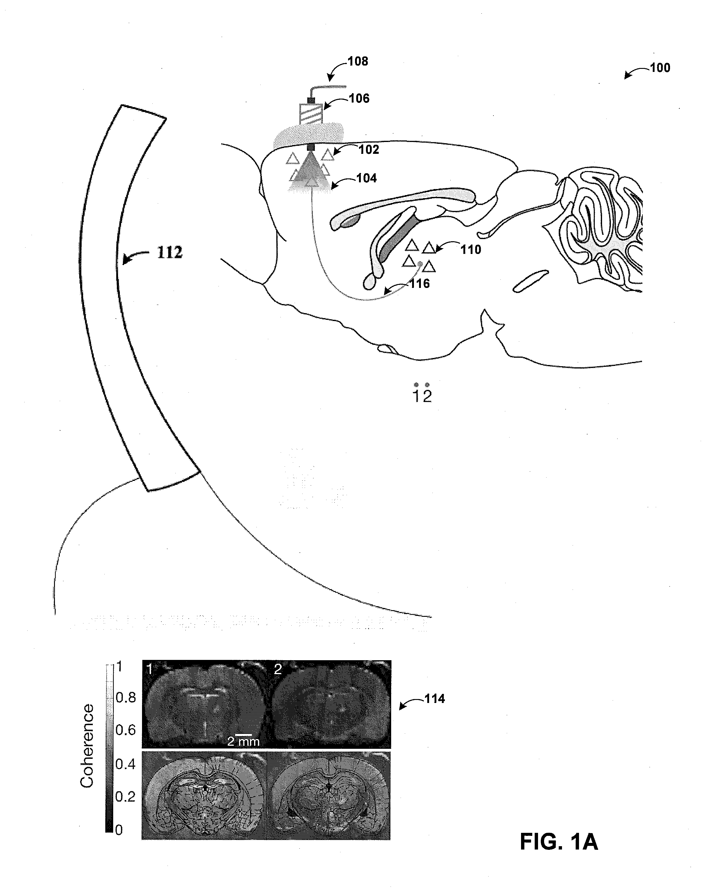 Optogenetic magnetic resonance imaging