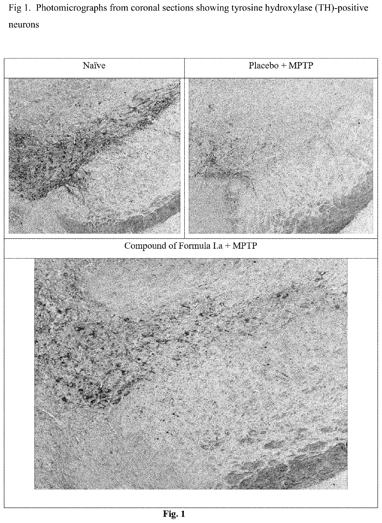 Treatment for parkinson's disease