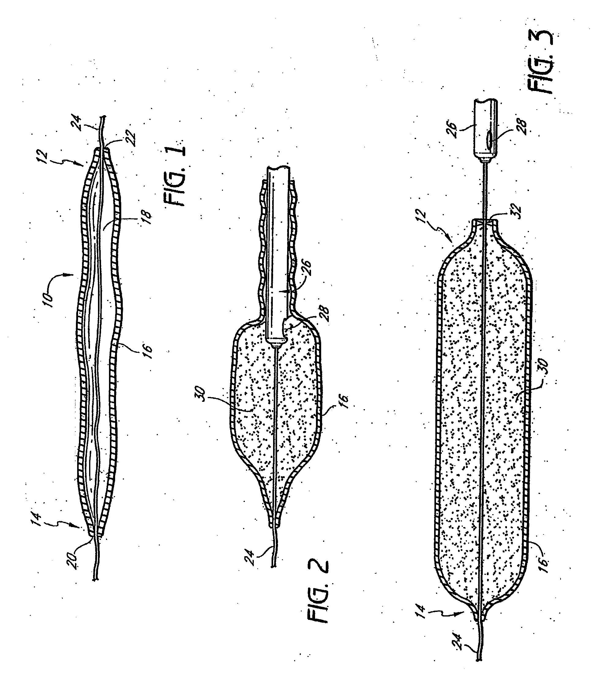 Tissue augmentation device