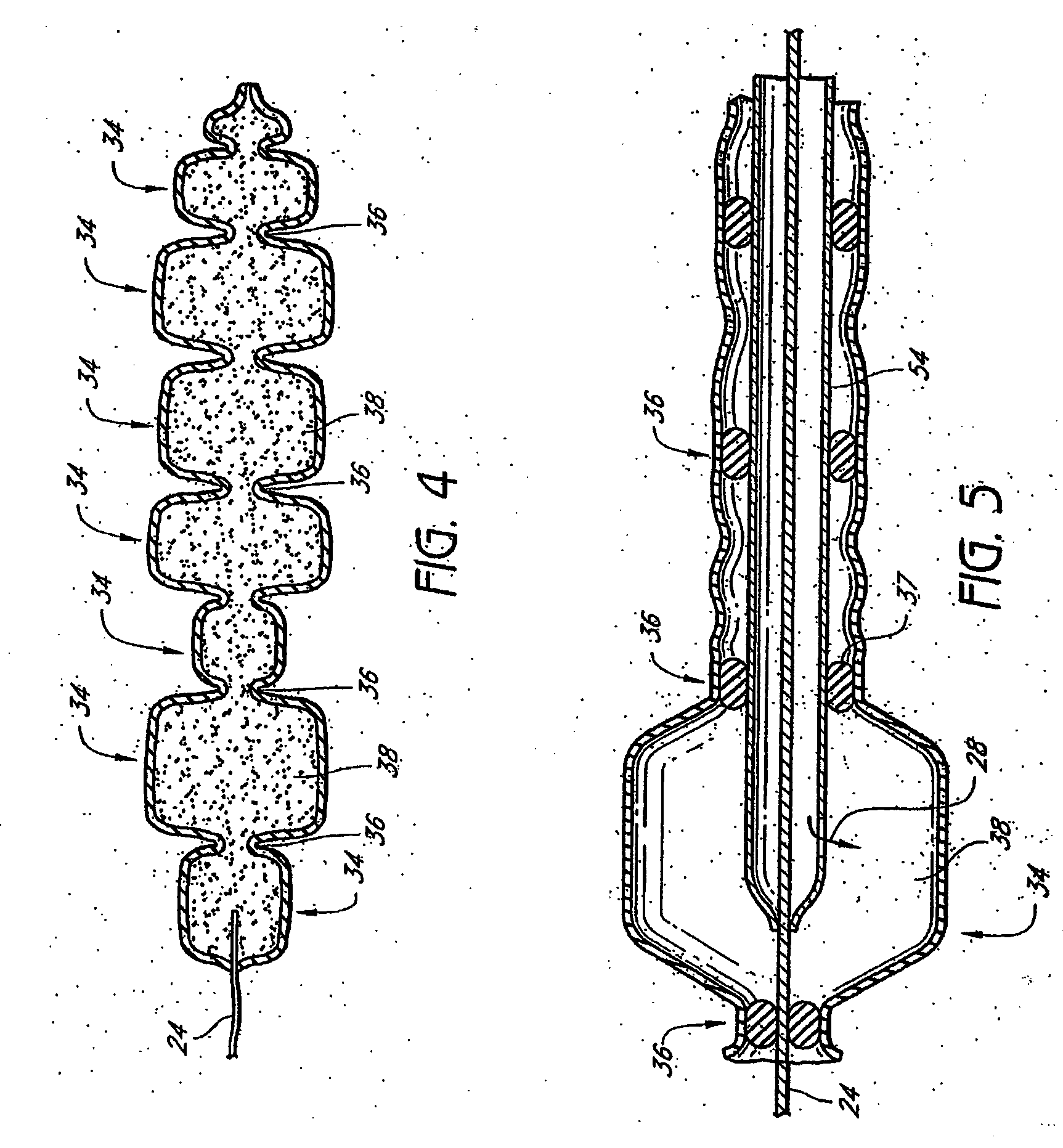 Tissue augmentation device