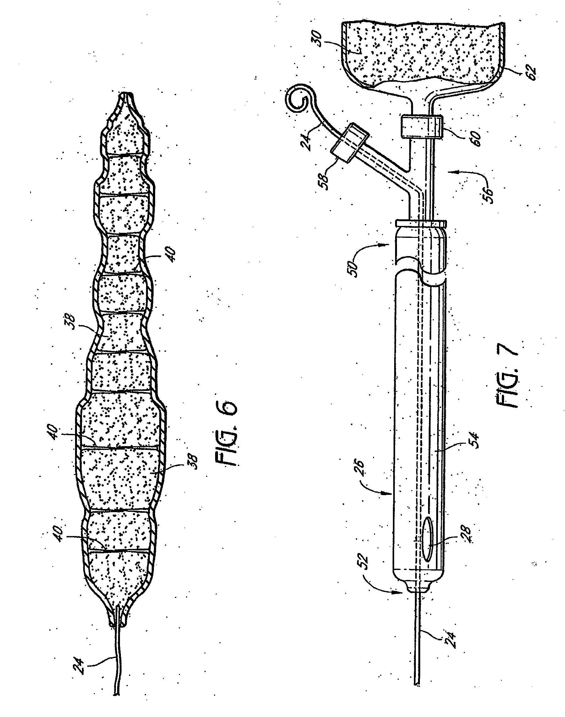 Tissue augmentation device