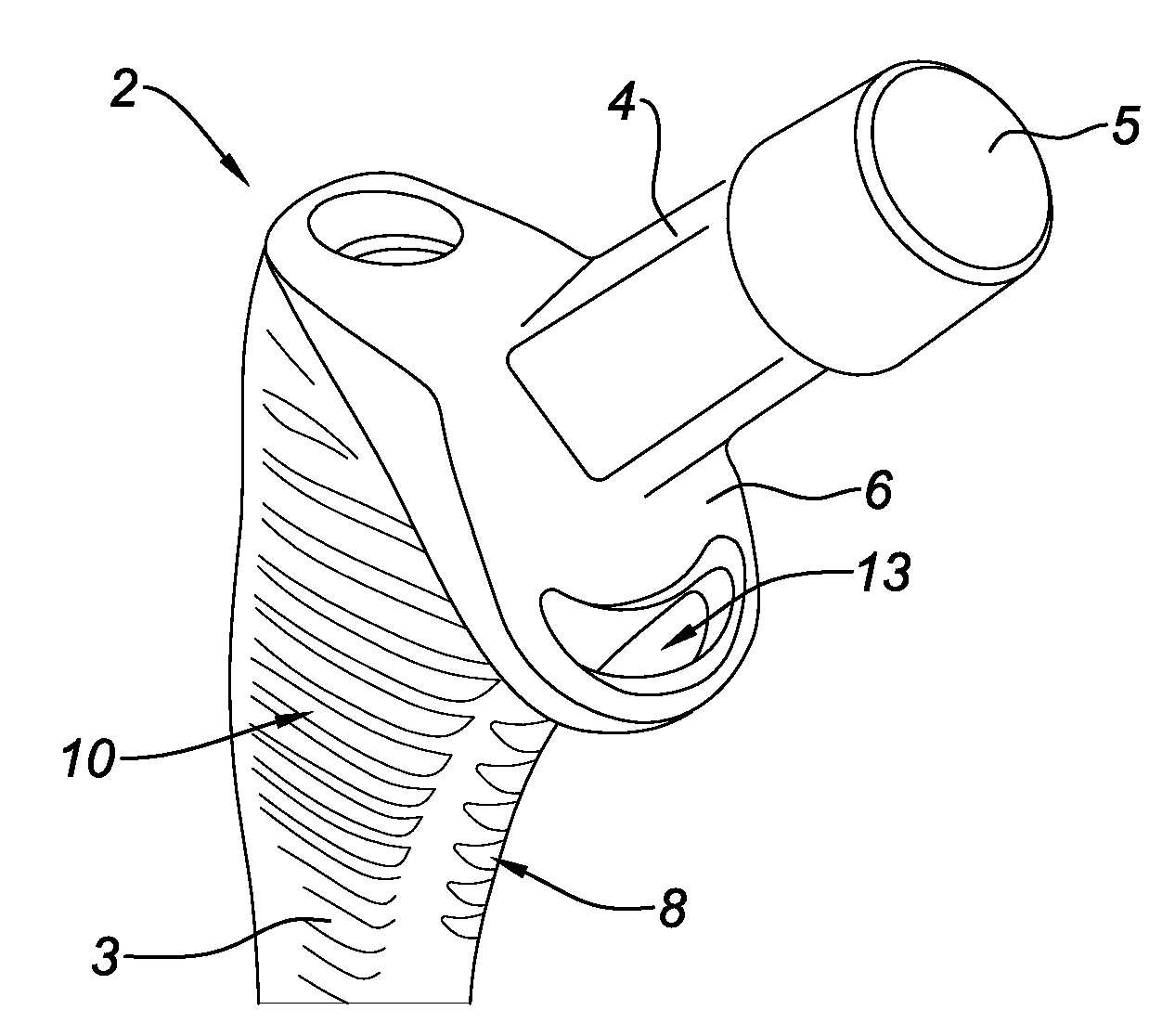 Hip prosthesis