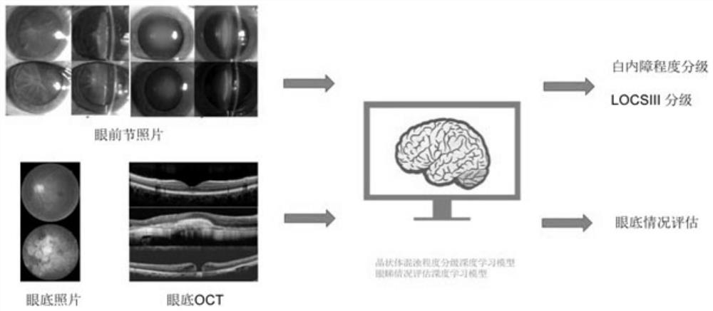 An intelligent prediction system for the prognosis of high myopia cataract surgery