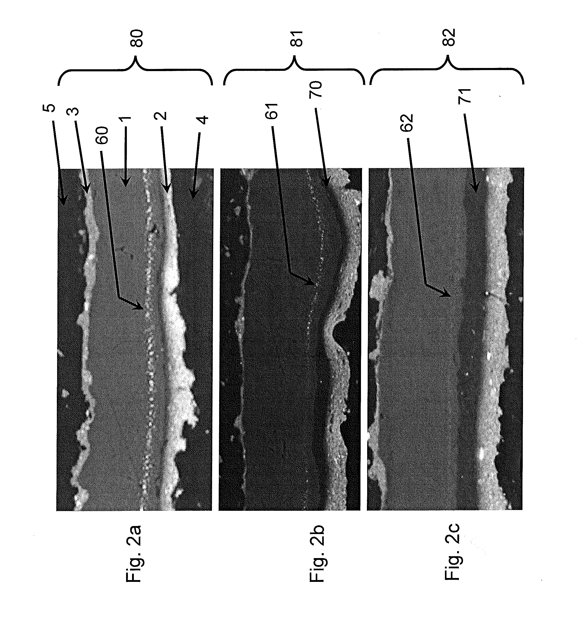 Membrane electrode assembly comprising a catalyst migration barrier layer