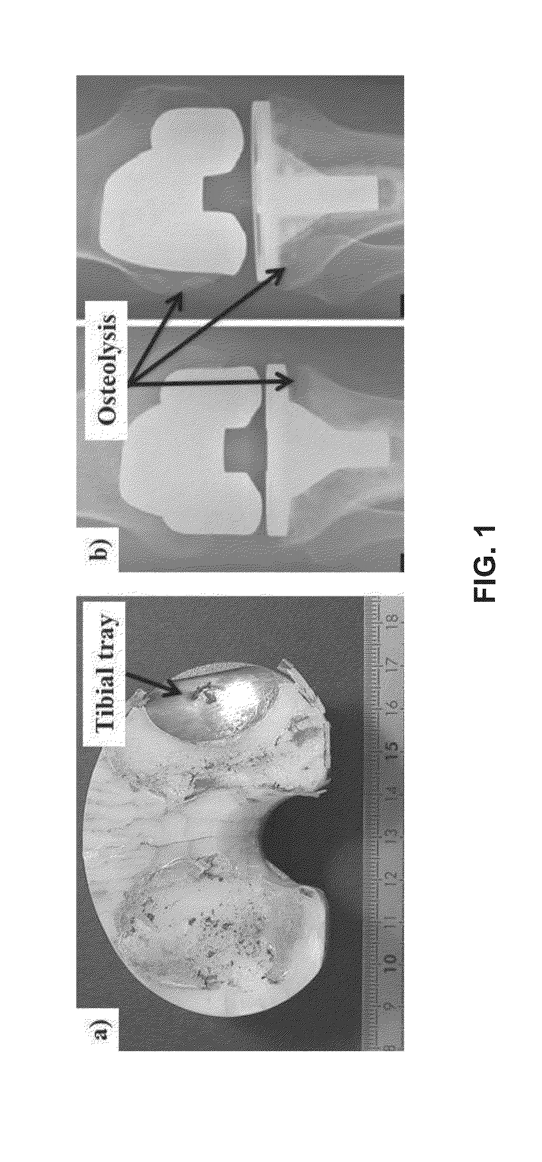 Orthopaedic Joints Providing Enhanced Lubricity