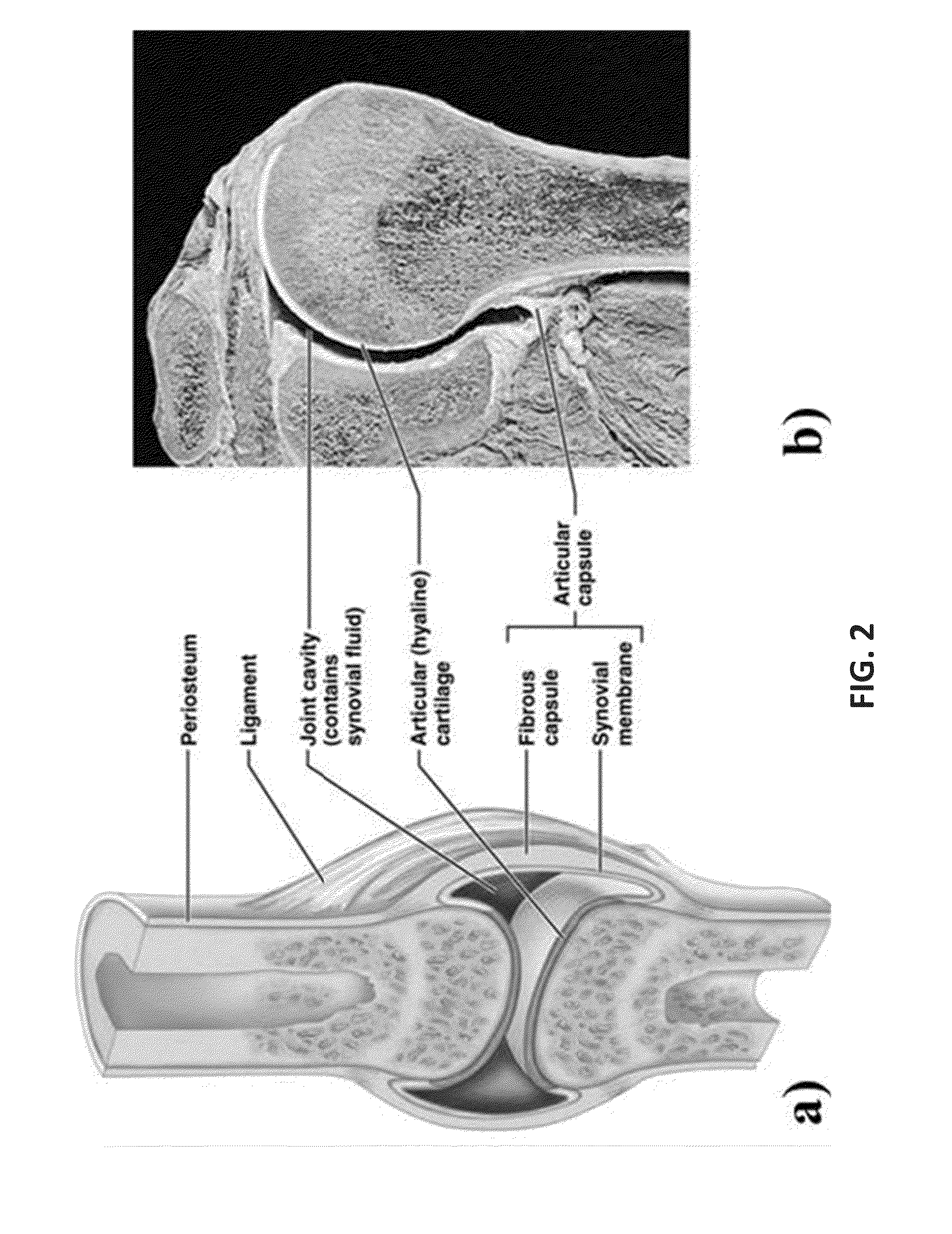 Orthopaedic Joints Providing Enhanced Lubricity