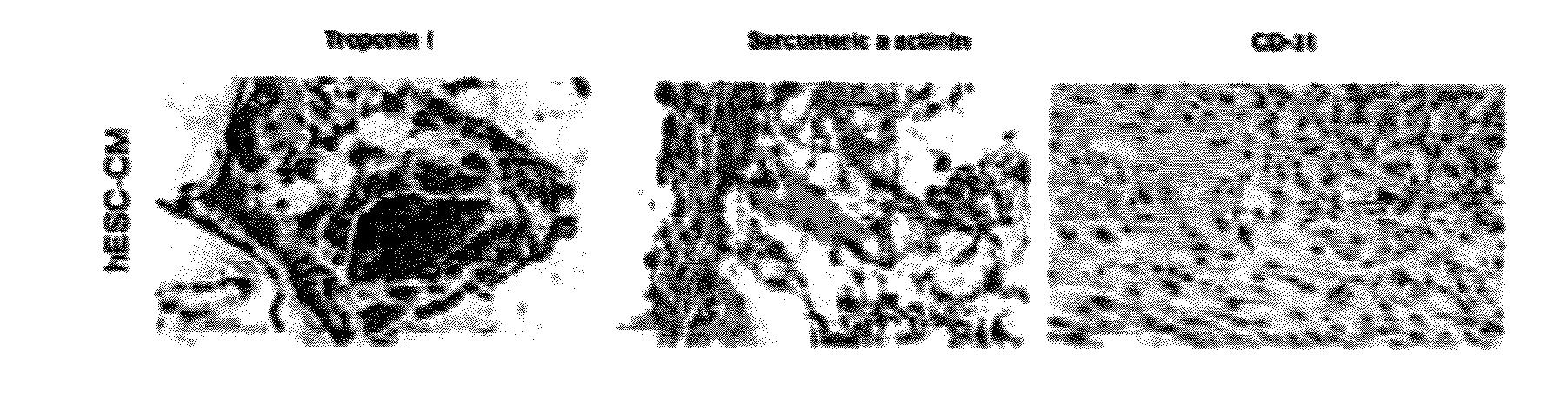 Vascularized cardiac tissue and methods of producing and using same