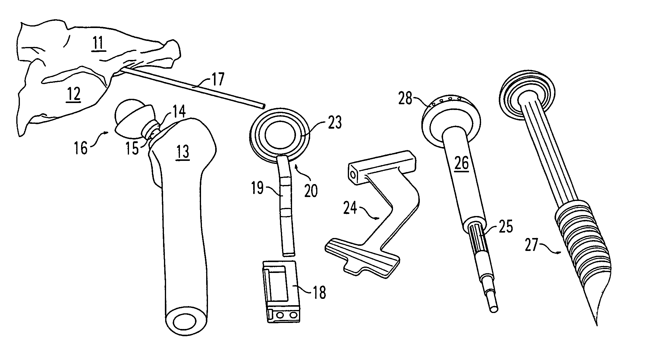 Accessory for implanting a hip endoprosthesis, and method for manipulating the same