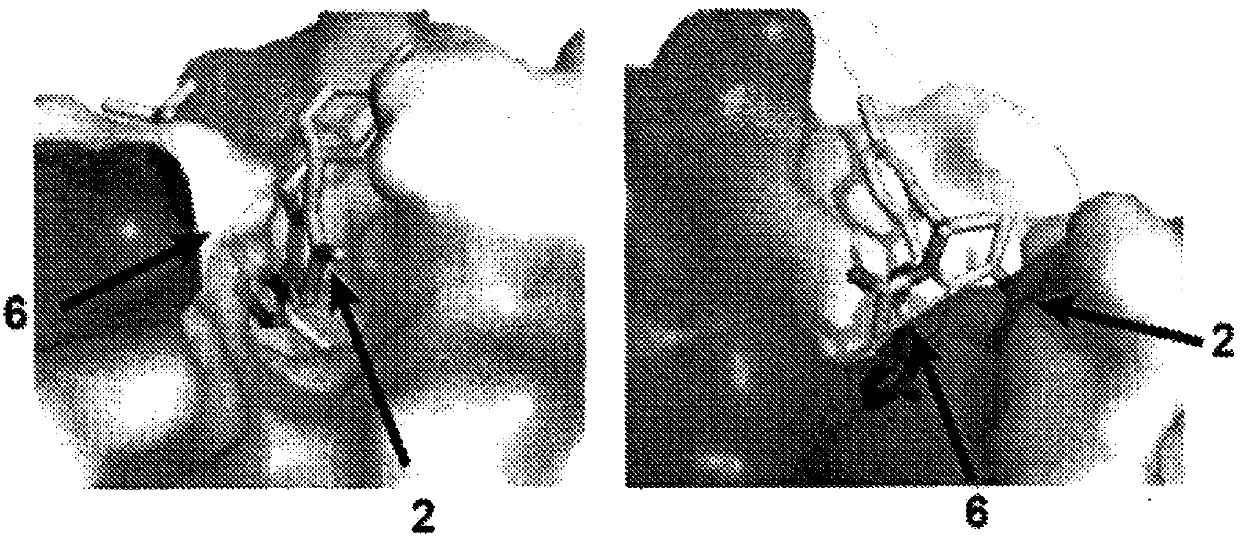 Bivalent bromodomain inhibitors and uses thereof