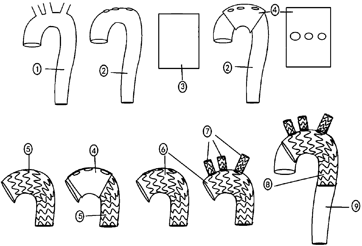 Method for rapidly preparing intraoperative individual covered stent for treating aortic arch dissection
