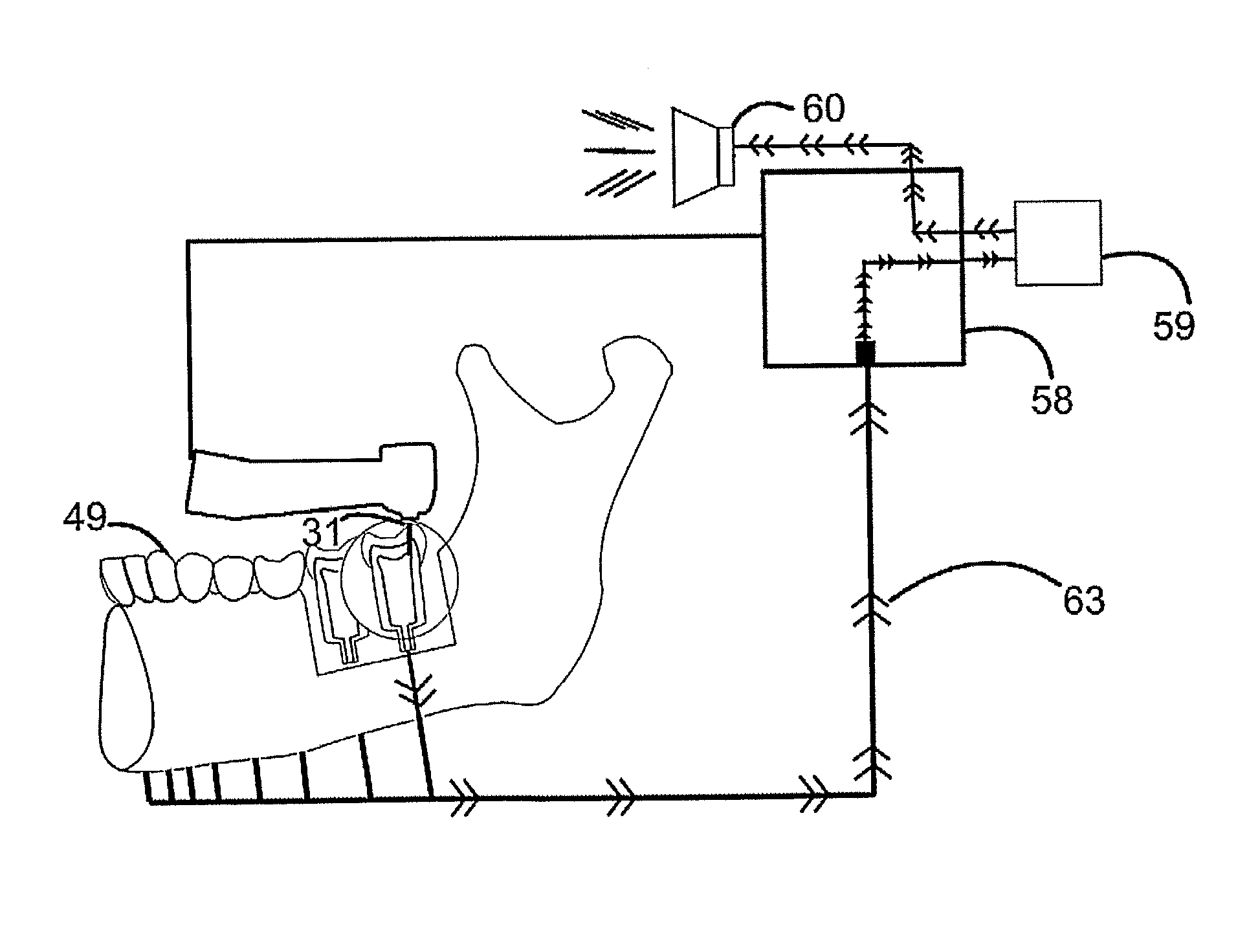 Method and a device for practicing dental treatments