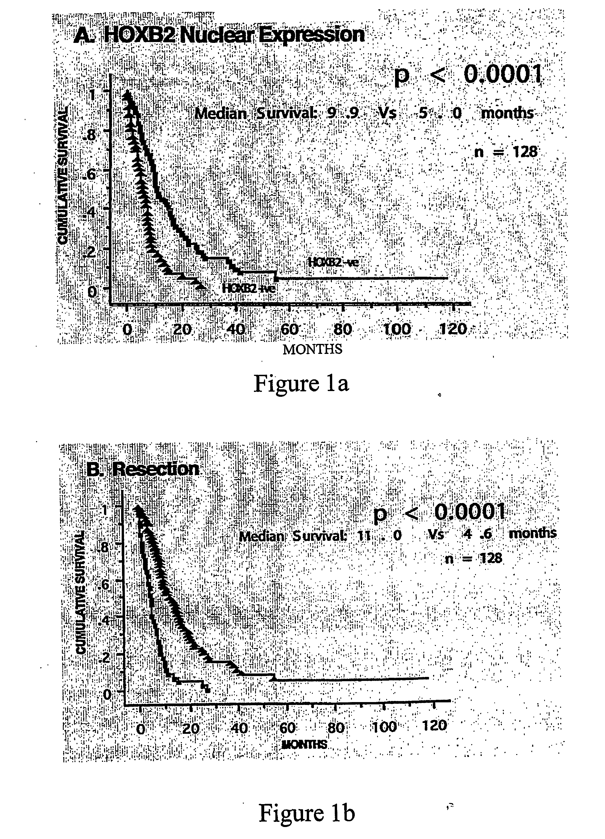 Methods of diagnosis and prognosis of pancreatic cancer