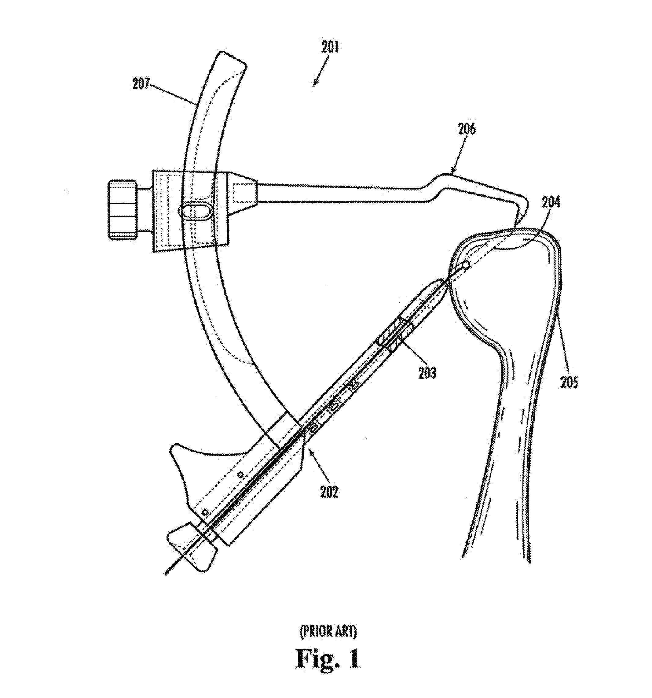 Method for drilling enlarged sections of angled osteal tunnels