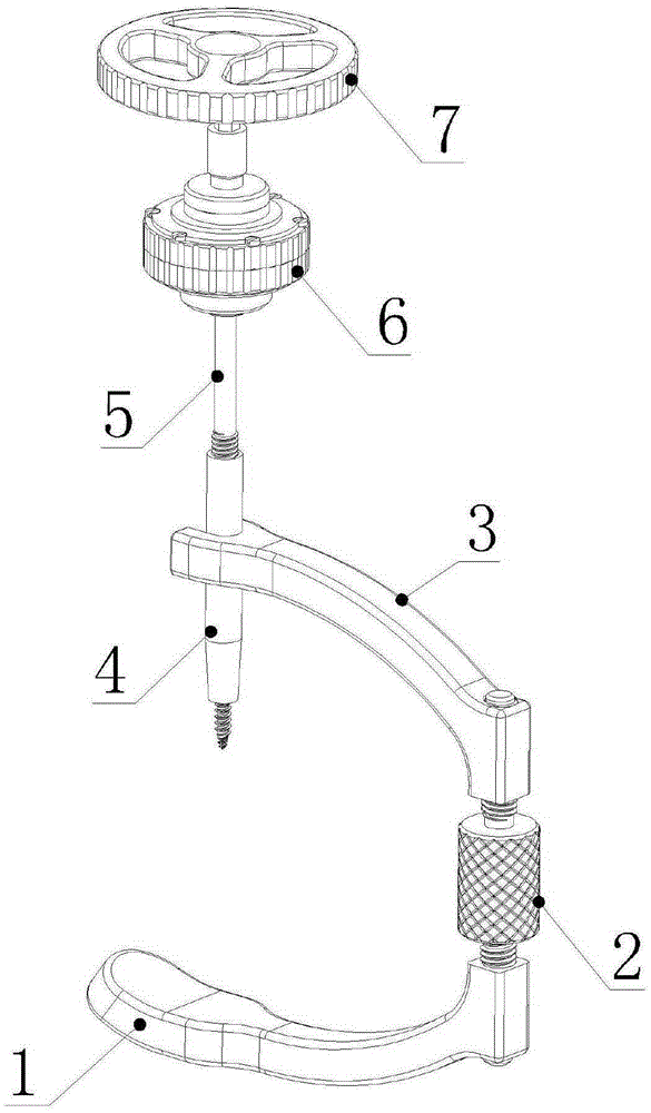 Bare-handed nail implantation external fixation system