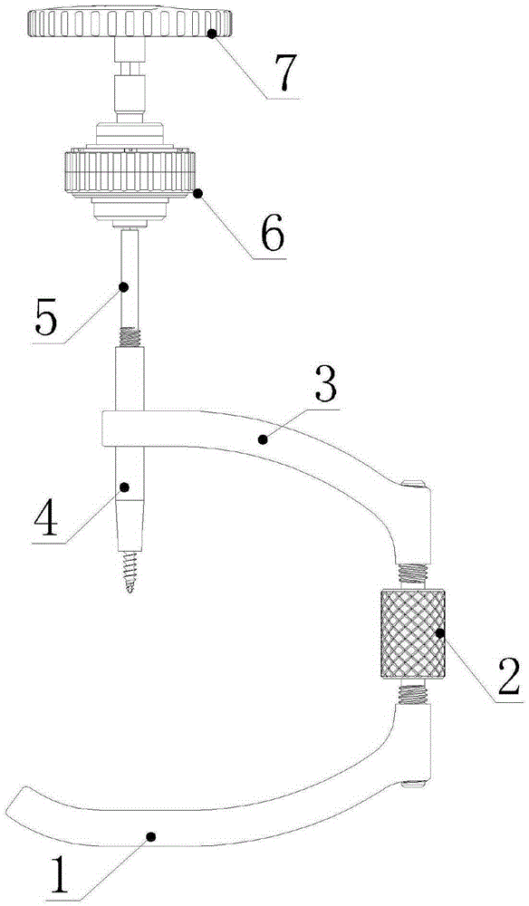 Bare-handed nail implantation external fixation system