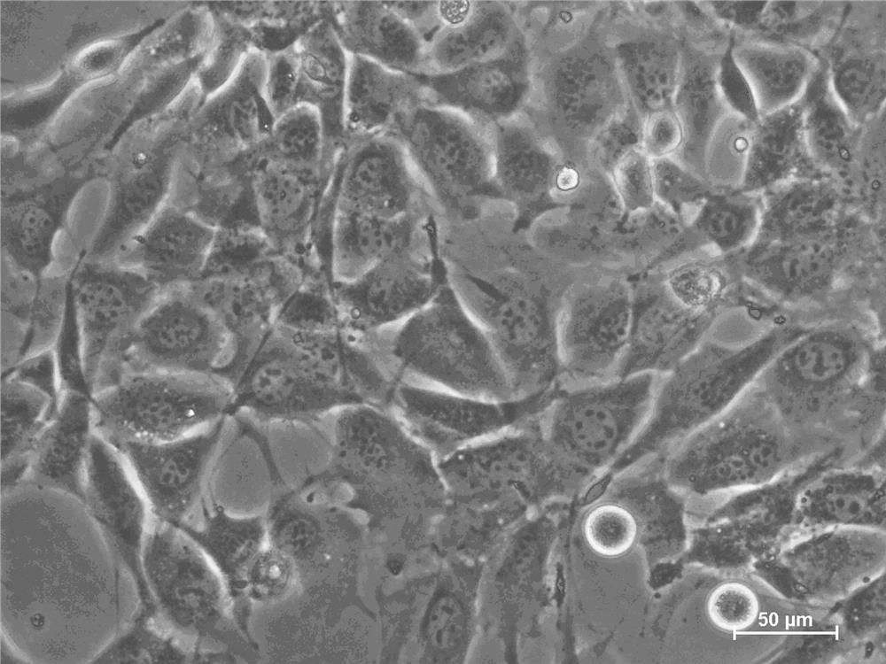 Lymph node-derived lymphoma-related fibroblast tumor cell strain and application thereof