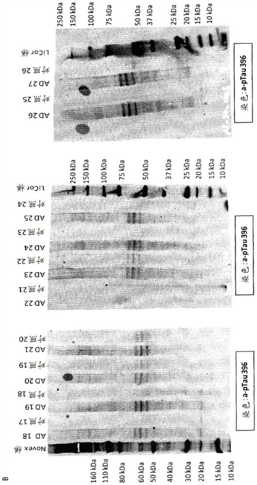 Phospho-specific antibody that recognizes tau