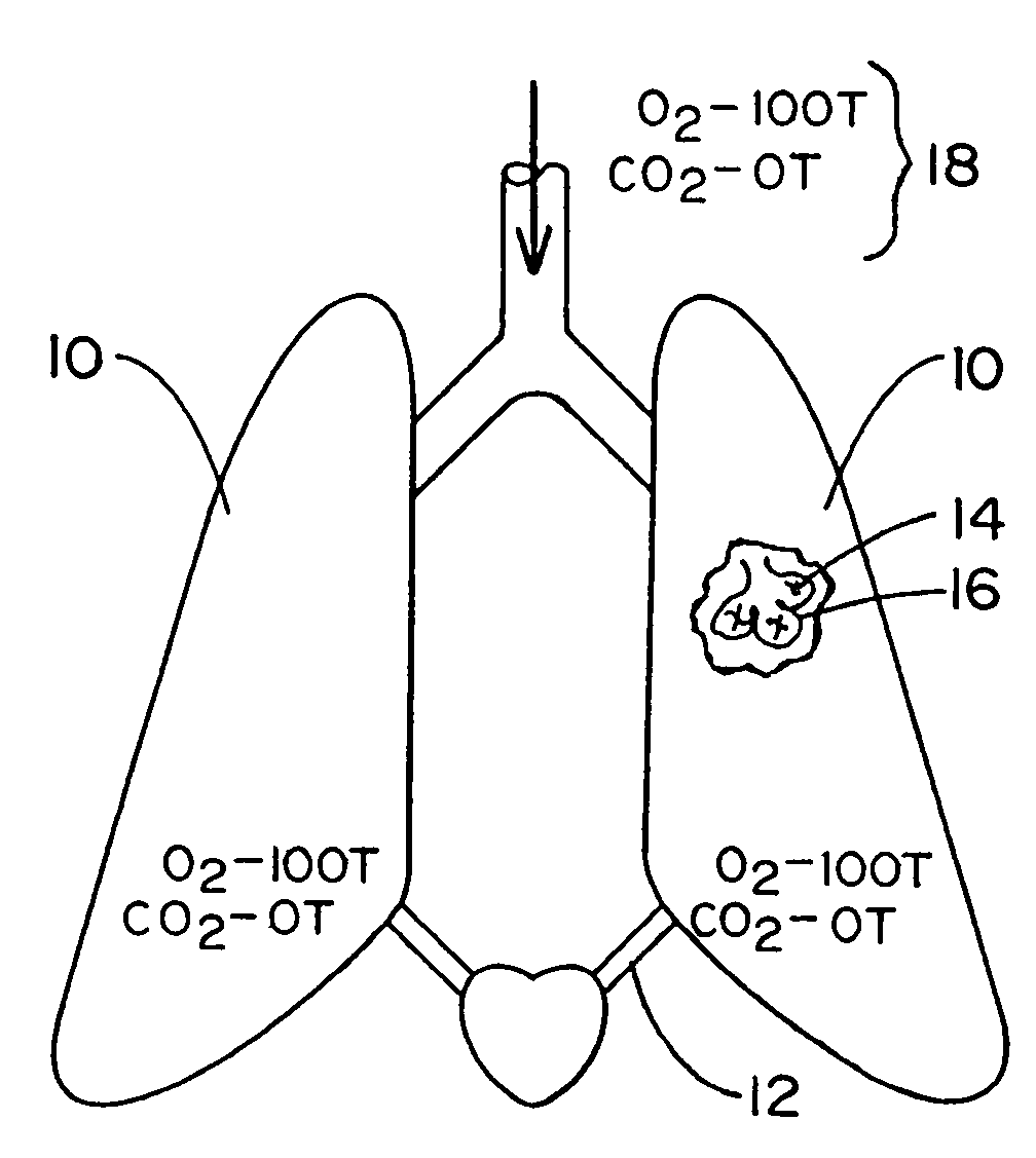 Non-invasive device and method for the diagnosis of pulmonary vascular occlusions