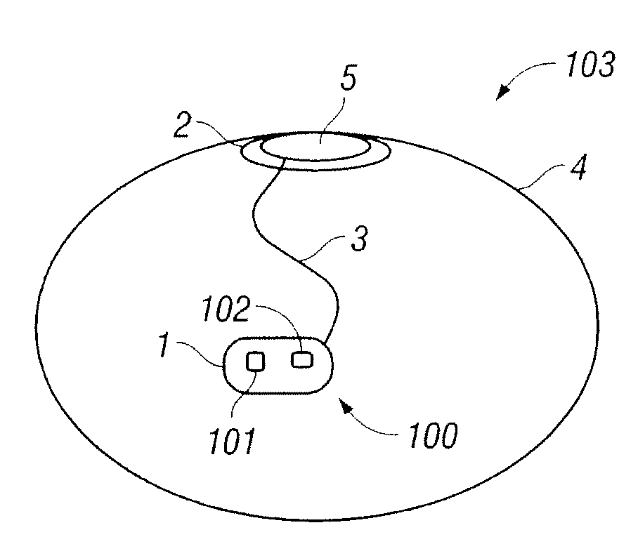 External sensing for implant rupture