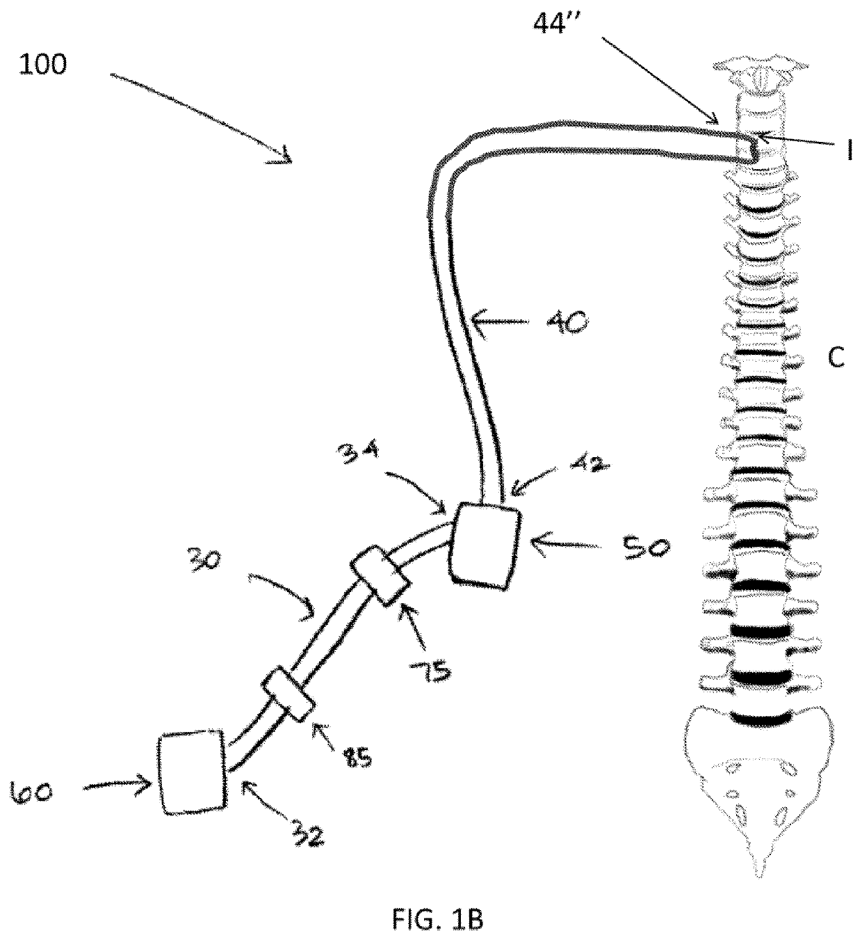 Therapeutic applications of artificial cerebrospinal fluid and tools provided therefor