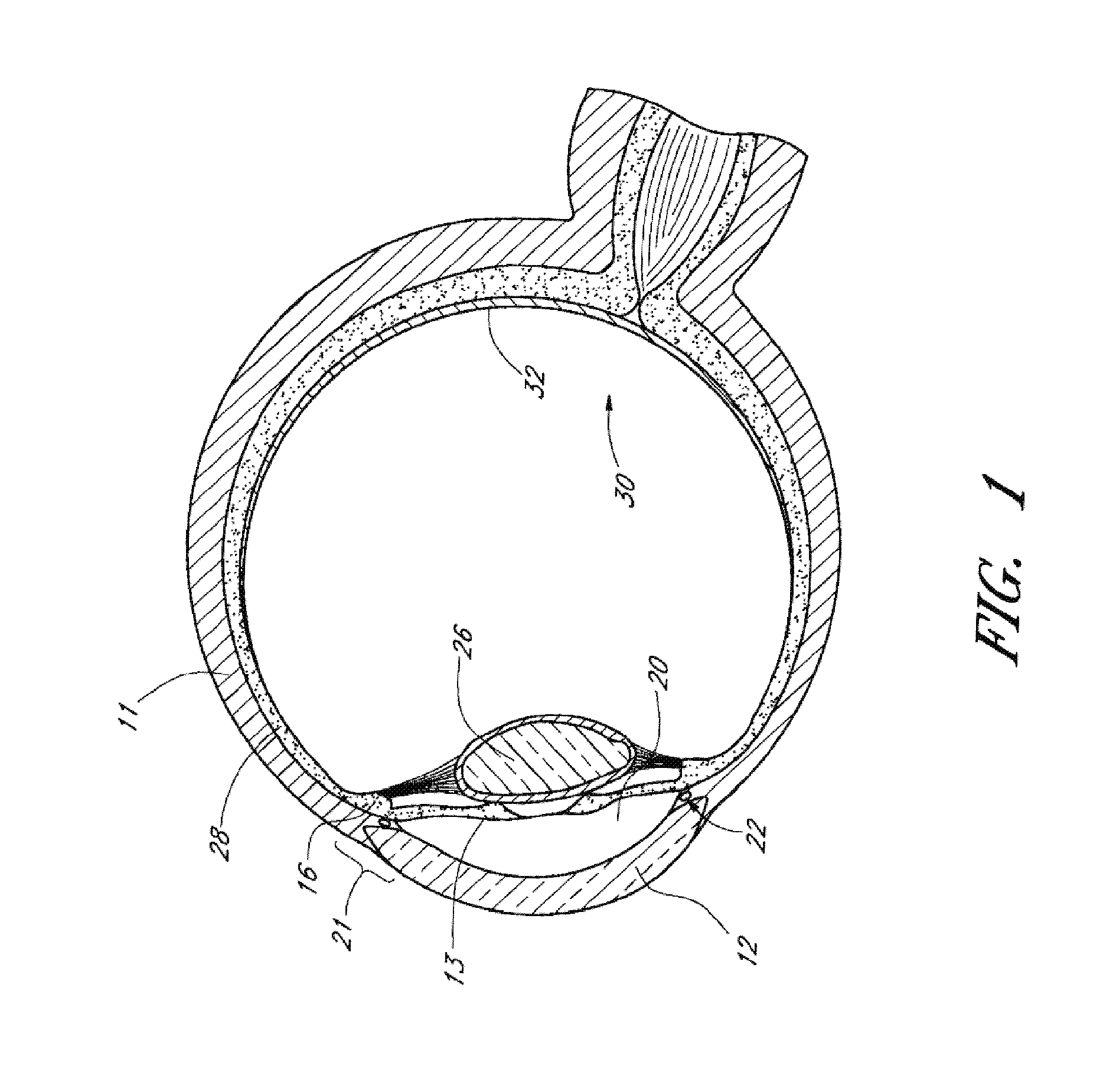 Implants with controlled drug delivery features and methods of using same