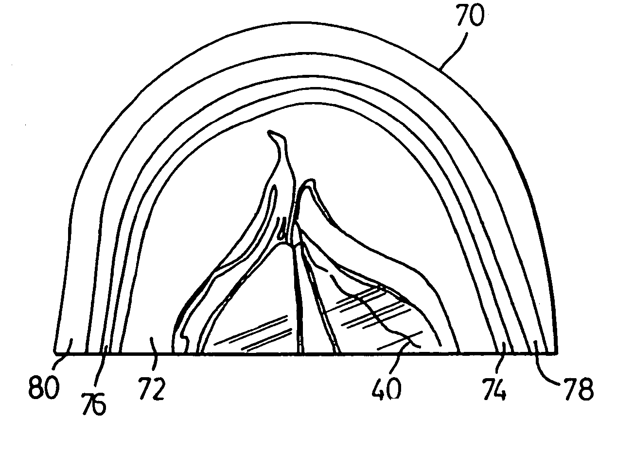 Sealing bead