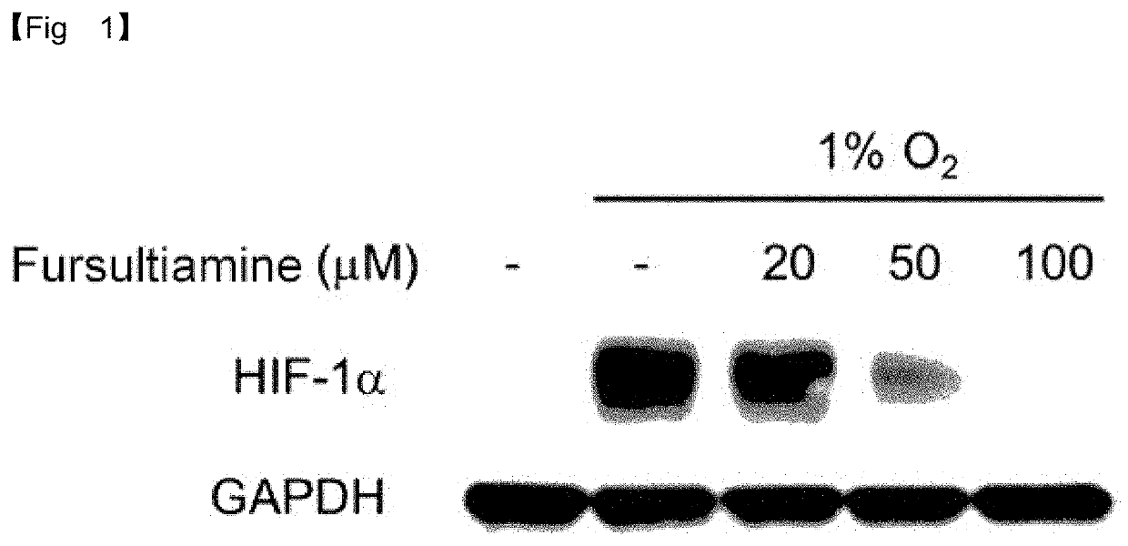 Composition for prevention or treatment of macular degeneration