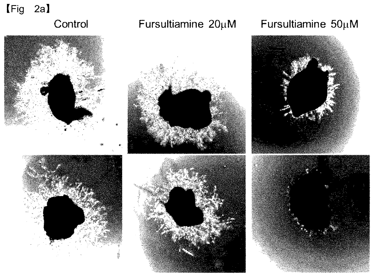 Composition for prevention or treatment of macular degeneration