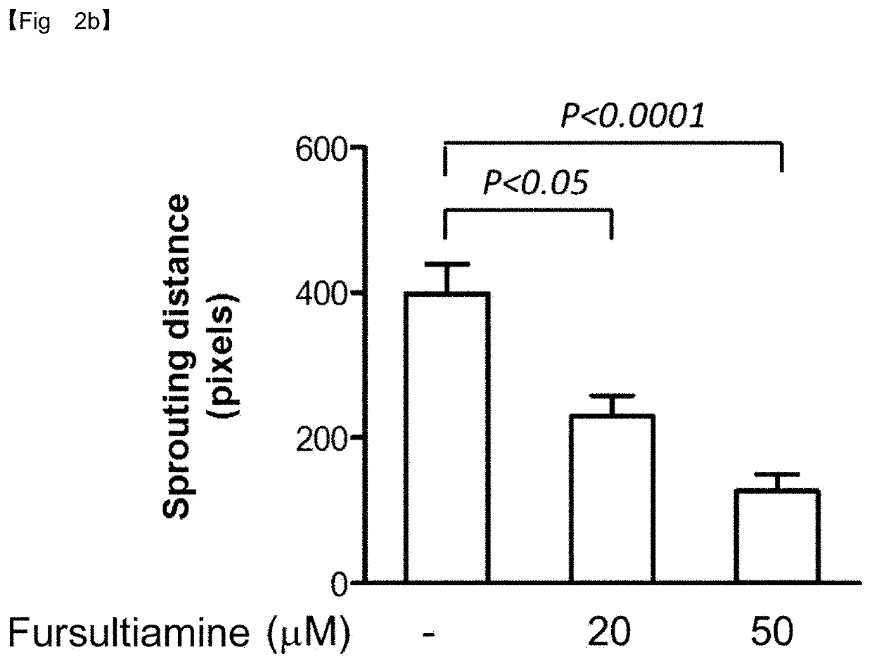 Composition for prevention or treatment of macular degeneration